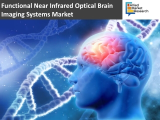 Functional Near Infrared Optical Brain Imaging Systems Market