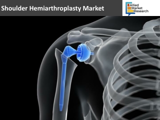 Shoulder Hemiarthroplasty Market