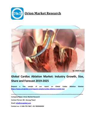 Cardiac Ablation Market Size, Share & Trends Analysis Report and Forecast 2019-2025