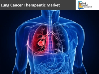 Lung Cancer Therapeutic Market expected to Grow faster with key winning strategies