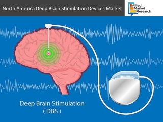 North America Deep Brain Stimulation Devices Market Statistics 2019: New Launches and Innovation to Boost Growth