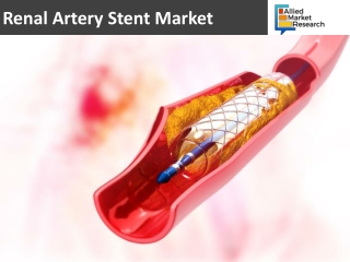 Renal Artery Stent Market Statistics 2019: Big Factors May Boost the Industry around the Globe