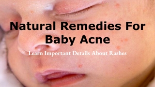 Natural Remedies For Baby Acne