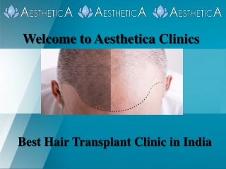 Best Hair Transplant Clinic in India