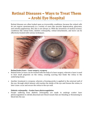 Retinal Diseases – Ways To Treat Them - Arohi Eye Hospital