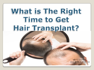 What is the right time to get Hair Transplant?