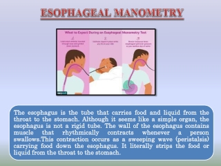 ESOPHAGEAL MANOMETRY