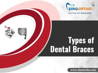 Types of Braces offered by Sino Orthodontic Products of China