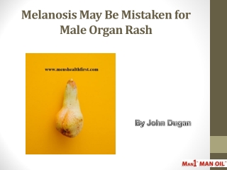 Melanosis May Be Mistaken for Male Organ Rash
