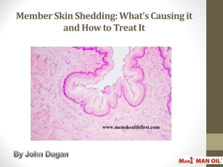Member Skin Shedding: What’s Causing it and How to Treat It