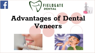 Advantages of Dental Veneers