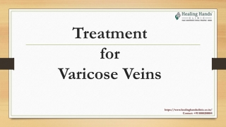 Best Treatment for Varicose Veins