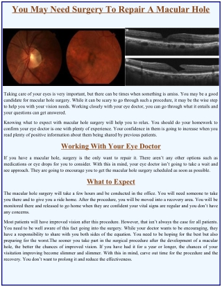 You May Need Surgery To Repair A Macular Hole