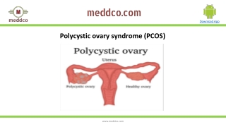 Polycystic ovary syndrome (PCOS)| Meddco