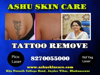 Laser Hair Removal Doctor - skin specialist in apollo bhubaneswar