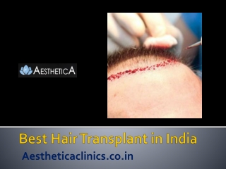 Best hair transplant in india