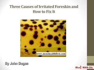 Three Causes of Irritated Foreskin and How to Fix It