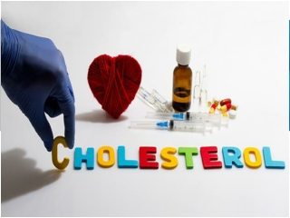 Purchase Generic Cholesterol Drugs