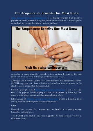 The Acupuncture Benefits One Must Know