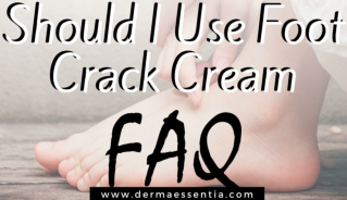Should I Use Foot Crack Cream ~ FAQ