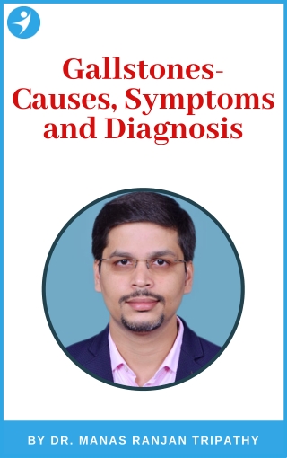 Gallstone Treatment in HSR Layout | Gallstone: Causes & Diagnosis