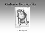 Cirrhose et H patopathies