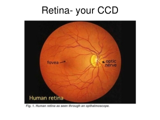 Retina- your CCD