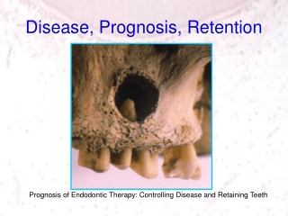 Disease, Prognosis, Retention