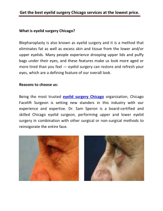 Get the best eyelid surgery Chicago services at the lowest price.
