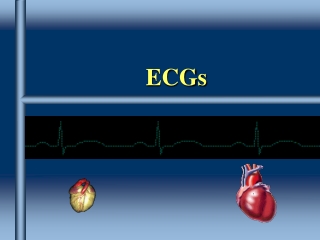 ECGs