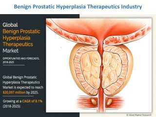Benign Prostatic Hyperplasia Therapeutics Industry Expected to Witness a Sustainable Growth