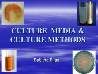 CULTURE  MEDIA &amp; CULTURE METHODS