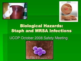 Biological Hazards: Staph and MRSA Infections