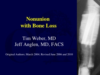 Nonunion  with Bone Loss