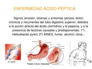 ENFERMEDAD ÁCIDO-PÉPTICA