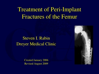 Treatment of Peri-Implant Fractures of the Femur