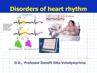 Disorders of heart rhythm