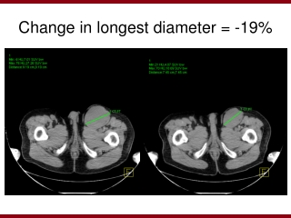 Change in longest diameter = -19%