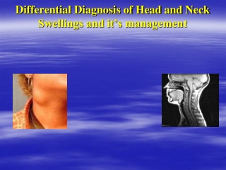 Differential Diagnosis of Head and Neck Swellings and it’s management