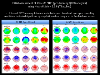 BF  Q1  Eyes Open