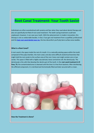 Root Canal Treatment- Your Tooth Savior