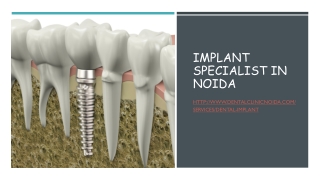 Implant specialist in Noida