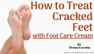 How to treat Cracked Feet with Foot Care Cream