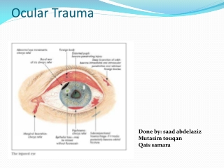 Ocular Trauma