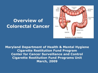 Overview of  Colorectal Cancer