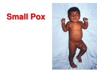 Small Pox