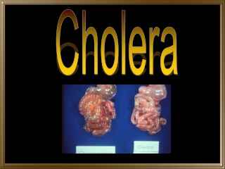 Cholera