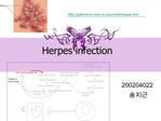 Herpes infection