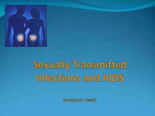 Sexually Transmitted Infections and AIDS Davenport- Health