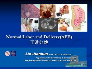 Normal Labor and Delivery(AFE) 正常分娩